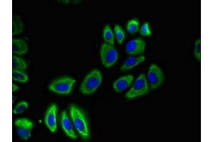 Immunofluorescent analysis of A549 cells using ABIN7170088 at dilution of 1:100 and Alexa Fluor 488-congugated AffiniPure Goat Anti-Rabbit IgG(H+L) (SLC12A7 antibody  (AA 11-117))