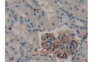Detection of GAL1 in Human Kidney Tissue using Polyclonal Antibody to Galectin 1 (GAL1) (LGALS1/Galectin 1 antibody  (AA 1-135))