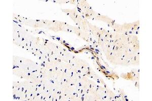 Immunohistochemistry analysis of paraffin-embedded rat heart using DLL4 Polyclonal Antibody at dilution of 1:200. (DLL4 antibody)
