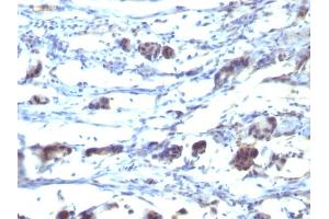 Formalin-fixed, paraffin-embedded human Stomach tissue stained with CD195 Mouse Monoclonal Antibody (12D1). (CCR5 antibody)