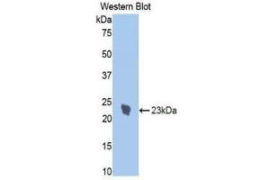 Western Blotting (WB) image for anti-Interleukin 1 Receptor, Type I (IL1R1) (AA 386-553) antibody (ABIN3209483) (IL1R1 antibody  (AA 386-553))
