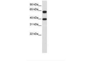 Image no. 3 for anti-Nuclear RNA Export Factor 3 (NXF3) (AA 435-484) antibody (ABIN203198) (NXF3 antibody  (AA 435-484))