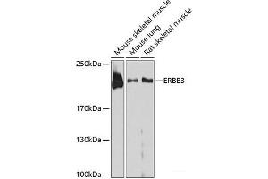 Western blot analysis of extracts of various cell lines using ERBB3 Polyclonal Antibody at dilution of 1:1000. (ERBB3 antibody)