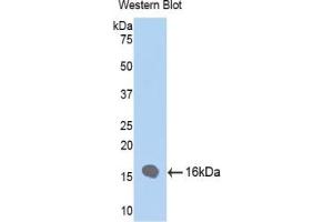 SDS-PAGE of Protein Standard from the Kit  (Highly purified E. (FABP4 ELISA Kit)