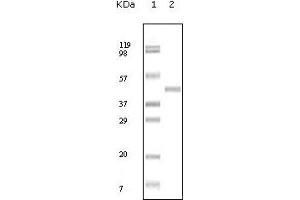 Western blot analysis using ABL2 mouse mAb against truncated ABL2 recombinant protein. (ABL2 antibody)