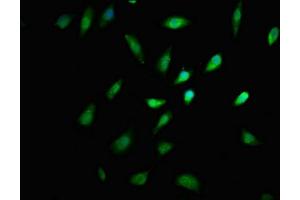 Immunofluorescence staining of SH-SY5Y cells with ABIN7158375 at 1:167, counter-stained with DAPI. (LIMD2 antibody  (AA 1-127))