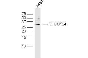 Human A431 cells probed with CCDC124 Polyclonal Antibody, unconjugated  at 1:300 overnight at 4°C followed by a conjugated secondary antibody at 1:10000 for 90 minutes at 37°C. (CCDC124 antibody  (AA 145-223))
