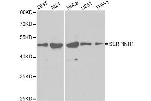 Western blot analysis of extracts of various cell lines, using SERPINH1 antibody (ABIN5971349) at 1/1000 dilution. (SERPINH1 antibody)