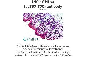 Image no. 1 for anti-G Protein-Coupled Estrogen Receptor 1 (GPER) (AA 357-370) antibody (ABIN1735055) (GPER antibody  (AA 357-370))