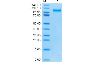 Mouse MMP-9 on Tris-Bis PAGE under reduced condition. (MMP 9 Protein (AA 20-730) (His tag))