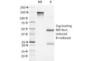 SDS-PAGE Analysis Purified BCL-6 Mouse Monoclonal Antibody (BCL6/1527). (BCL6 antibody  (AA 256-389))