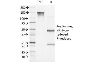 SDS-PAGE Analysis Purified BCL-6 Mouse Monoclonal Antibody (BCL6/1527). (BCL6 antibody  (AA 256-389))