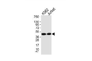 Western blot analysis of extracts from, K562 cells (Lane 1) and Jurket cells (Lane 2), using Mnk1 (Ab-385) Antibody. (MKNK1 antibody)