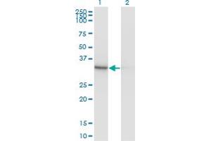 Western Blot analysis of PDXK expression in transfected 293T cell line by PDXK monoclonal antibody (M03), clone 4G6. (PDXK antibody  (AA 1-312))