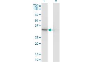 Western Blot analysis of PDXK expression in transfected 293T cell line by PDXK monoclonal antibody (M03), clone 4G6.