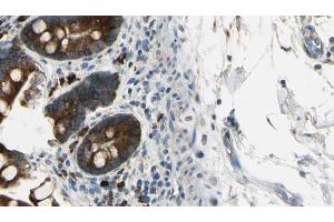 ABIN6267449 at 1/100 staining Mouse intestine tissue by IHC-P. (CXCR2 antibody  (pSer347))