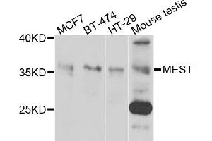 Western blot analysis of extracts of various cell lines, using MEST antibody.