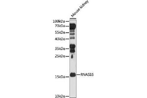 Western blot analysis of extracts of Mouse kidney, using RN antibody (ABIN7269987) at 1:1000 dilution. (RNASE6 antibody  (AA 1-150))