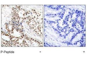 Image no. 1 for anti-Breast Cancer 1 (BRCA1) (pSer1423) antibody (ABIN196995) (BRCA1 antibody  (pSer1423))