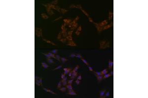 Immunofluorescence analysis of C6 cells using IRF6 Rabbit mAb (ABIN1680921, ABIN3017588, ABIN3017589 and ABIN7101507) at dilution of 1:100 (40x lens).