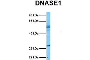 Host:  Rabbit  Target Name:  DNASE1  Sample Tissue:  Human Lung Tumor  Antibody Dilution:  1. (DNASE1 antibody  (N-Term))