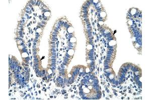 Fibrillarin antibody was used for immunohistochemistry at a concentration of 4-8 ug/ml to stain Epithelial cells of intestinal villus (arrows) in Human Intestine. (Fibrillarin antibody  (N-Term))