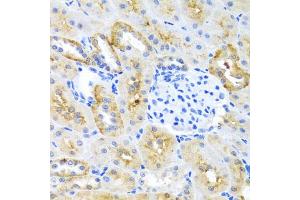 Immunohistochemistry of paraffin-embedded mouse kidney using MOK antibody. (MOK antibody)