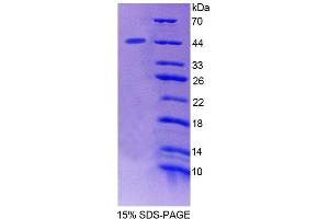 SDS-PAGE analysis of Mouse STAM2 Protein. (STAM2 Protein)