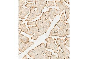 (ABIN392786 and ABIN2842224) staining PFKFB4 in human skeletal muscle tissue sections by Immunohistochemistry (IHC-P - paraformaldehyde-fixed, paraffin-embedded sections). (PFKFB4 antibody  (AA 266-296))