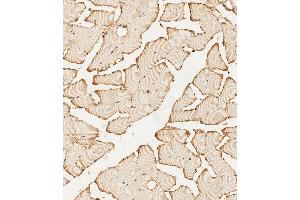(ABIN392786 and ABIN2842224) staining PFKFB4 in human skeletal muscle tissue sections by Immunohistochemistry (IHC-P - paraformaldehyde-fixed, paraffin-embedded sections).