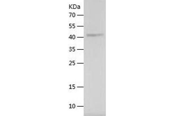 COL4a2 Protein (AA 1481-1707) (His-IF2DI Tag)