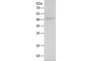Western Blotting (WB) image for Collagen, Type IV, alpha 2 (COL4A2) (AA 1481-1707) protein (His-IF2DI Tag) (ABIN7122445)