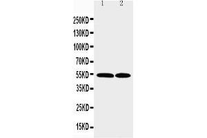 Anti-CCR3 antibody, Western blotting Lane 1: K562 Cell Lysate Lane 2: RAJI Cell Lysate (CCR3 antibody  (N-Term))