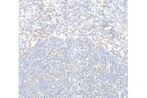 Immunohistochemistry (IHC) image for anti-Nucleoprotein TPR (TPR) (C-Term) antibody (ABIN7448922)