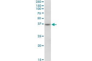 RHOXF2 MaxPab polyclonal antibody. (RHOXF2 antibody  (AA 1-288))