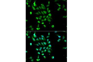 Immunofluorescence analysis of MCF7 cell using PSMC5 antibody. (PSMC5 antibody  (AA 127-406))
