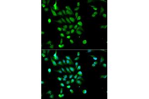 Immunofluorescence analysis of MCF7 cell using PSMC5 antibody. (PSMC5 antibody  (AA 127-406))