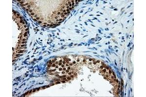 Immunohistochemical staining of paraffin-embedded Kidney tissue using anti-TPMT mouse monoclonal antibody. (TPMT antibody)