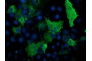 Immunofluorescence (IF) image for anti-Protein Kinase, CAMP-Dependent, Regulatory, Type I, beta (PRKAR1B) antibody (ABIN1500409)