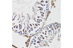 Immunohistochemistry of paraffin-embedded rat testis using Cyclin B1 antibody (ABIN7266555) at dilution of 1:100 (40x lens). (Cyclin B1 antibody  (C-Term))