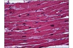 Immunohistochemistry (IHC) image for anti-B-Cell CLL/lymphoma 11A (Zinc Finger Protein) (BCL11A) (AA 1-89) antibody (ABIN782364) (BCL11A antibody  (AA 1-89))