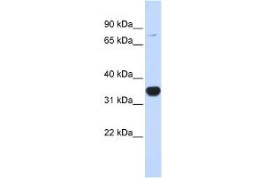 WB Suggested Anti-RHOT1 Antibody Titration:  0. (RHOT1 antibody  (N-Term))