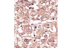 Image no. 2 for anti-Toll-Like Receptor 7 (TLR7) (N-Term) antibody (ABIN357057) (TLR7 antibody  (N-Term))