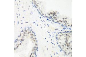 Immunohistochemistry of paraffin-embedded human prostate using PPAN antibody at dilution of 1:200 (40x lens). (PPAN antibody)