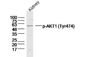 Mouse kidney lysates probed with AKT1/2/3 (Tyr474) Polyclonal Antibody, unconjugated  at 1:300 overnight at 4°C followed by a conjugated secondary antibody at 1:10000 for 90 minutes at 37°C. (AKT 1/2/3 antibody  (pTyr474))