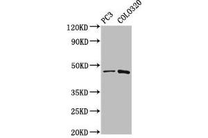 Western Blot Positive WB detected in: PC-3 whole cell lysate, Colo320 whole cell lysate All lanes: CAPS2 antibody at 5. (Calcyphosine 2 antibody  (AA 191-274))