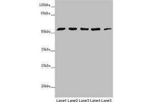 Western blot All lanes: CEP57L1 antibody at 6. (CEP57L1 antibody  (AA 1-167))