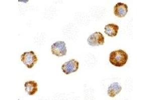 Immunohistochemistry (IHC) image for anti-Mitogen-Activated Protein Kinase Kinase Kinase 5 (MAP3K5) antibody (ABIN1030199) (ASK1 antibody)