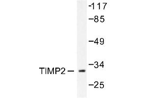 Image no. 1 for anti-Metalloproteinase Inhibitor 2 (TIMP2) antibody (ABIN271854) (TIMP2 antibody)