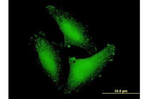 Immunofluorescence of purified MaxPab antibody to DCP2 on HepG2 cell. (DCP2 antibody  (AA 1-385))